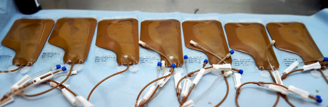 A donor’s fecal matter ready for transplanting / Photo Simon Mark Dahl Jørgensen